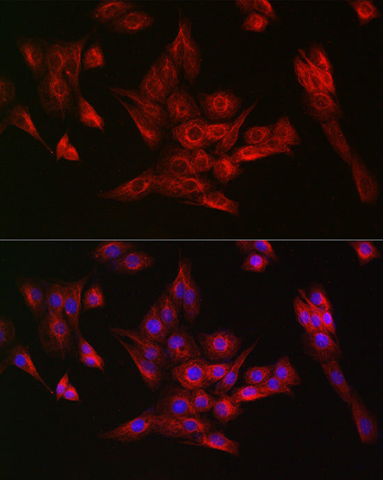 α-Tubulin Rabbit mAb