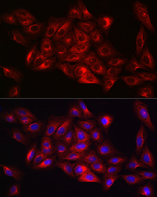 α-Tubulin Rabbit mAb