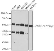 CDKN1C/p57 Kip2 Rabbit mAb