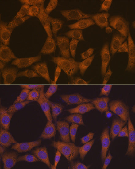 CAD Rabbit mAb