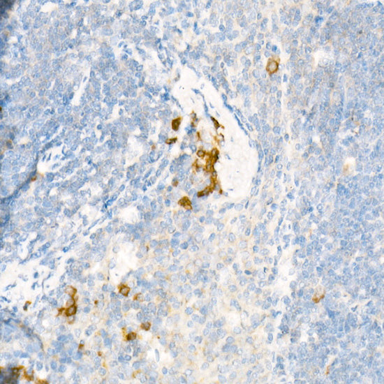 ALOX15 Rabbit pAb