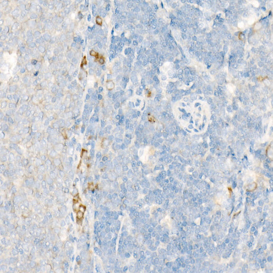 ALOX15 Rabbit pAb