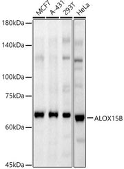 ALOX15B Rabbit pAb