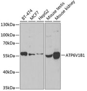 ATP6V1B1 Rabbit pAb