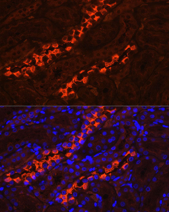 ATP6V1B1 Rabbit pAb