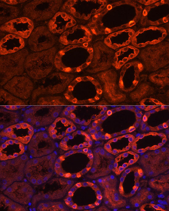 ATP6V1B1 Rabbit pAb