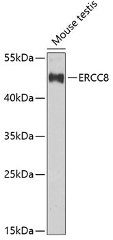 ERCC8 Rabbit pAb