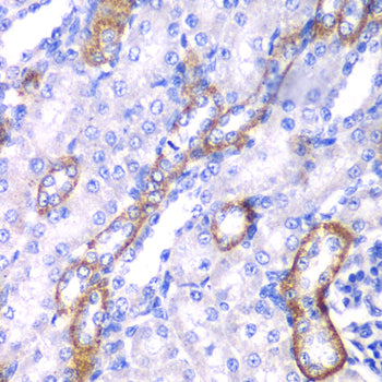 MYO1C Rabbit pAb