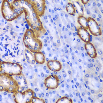 MYO1C Rabbit pAb