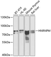 HNRNPM Rabbit pAb