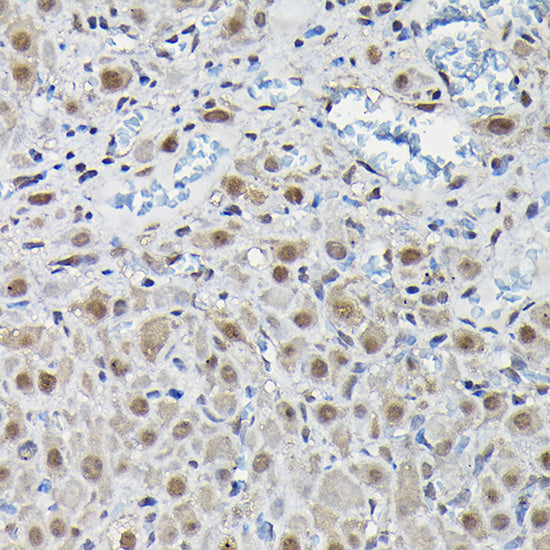 PFKFB3 Rabbit pAb
