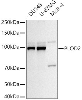 PLOD2/LH2 Rabbit pAb