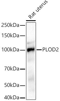 PLOD2/LH2 Rabbit pAb