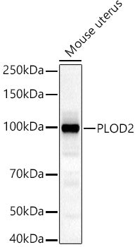 PLOD2/LH2 Rabbit pAb