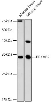 PRKAB2 Rabbit pAb