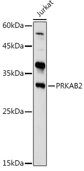 PRKAB2 Rabbit pAb