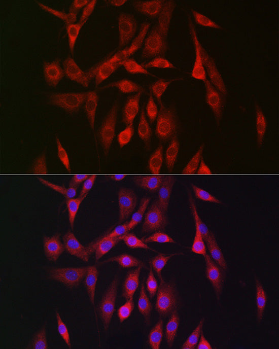 PRKAB2 Rabbit pAb