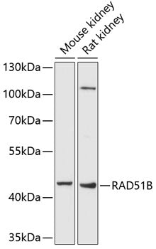 RAD51B Rabbit pAb