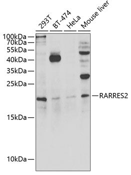 RARRES2 Rabbit pAb