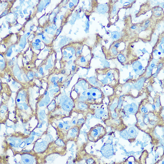 GLUT1/SLC2A1 Rabbit pAb