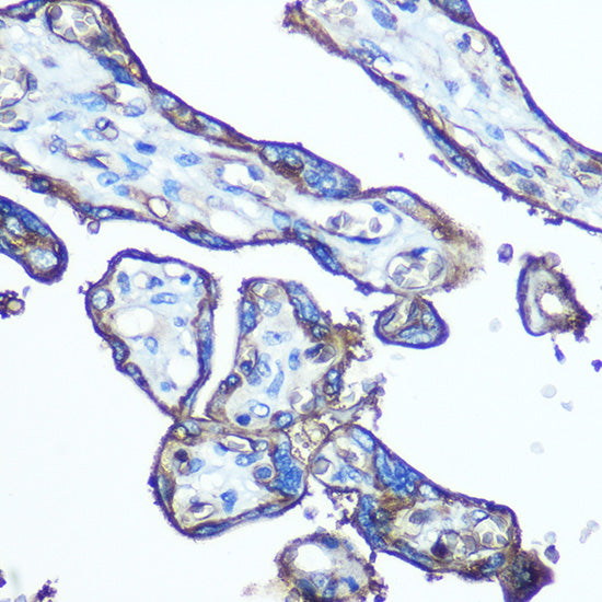 GLUT1/SLC2A1 Rabbit pAb