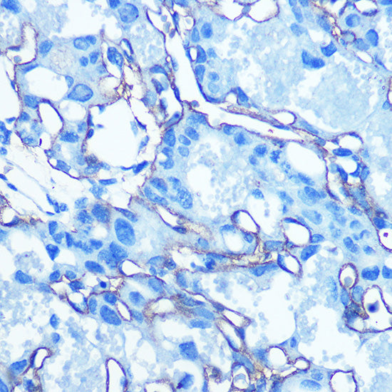 GLUT1/SLC2A1 Rabbit pAb