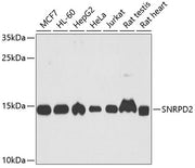 SNRPD2 Rabbit pAb