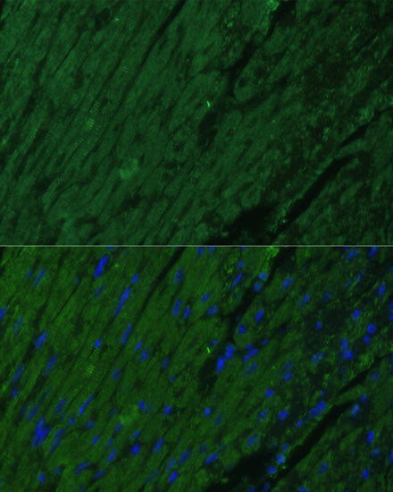 Cardiac Troponin I (TNNI3) Rabbit pAb