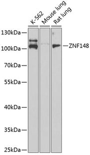 ZNF148 Rabbit pAb