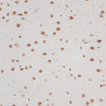 ZNF148 Rabbit pAb