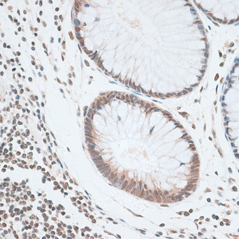 ZNF148 Rabbit pAb