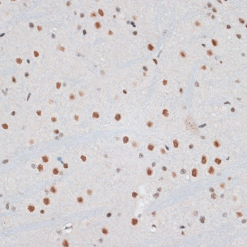 ZNF148 Rabbit pAb