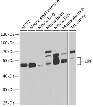 LIPF Rabbit pAb