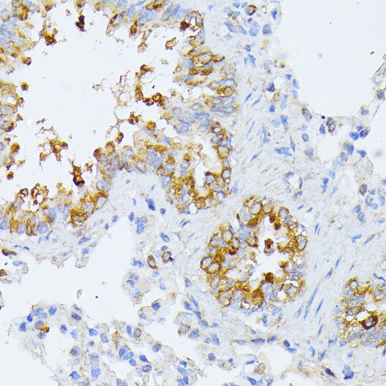 EIF2B2 Rabbit pAb