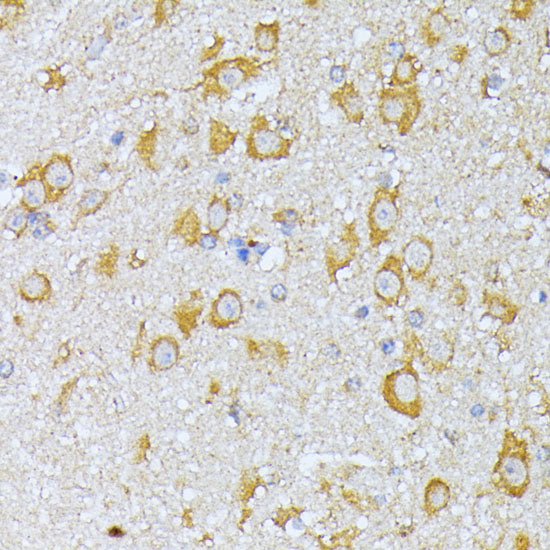 EIF2B2 Rabbit pAb