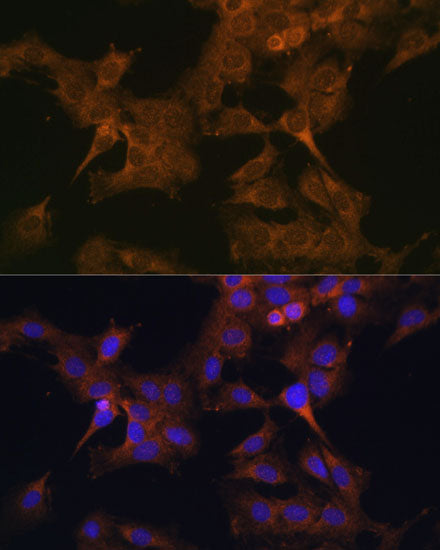 EIF2B2 Rabbit pAb