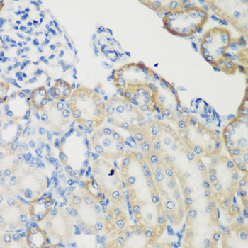TGM5 Rabbit pAb