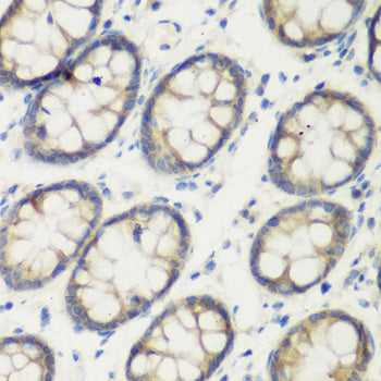 TGM5 Rabbit pAb