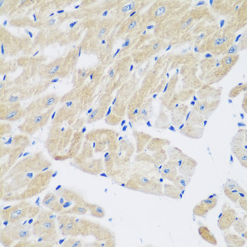 TGM5 Rabbit pAb