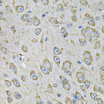 PDIA6 Rabbit pAb