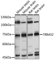 TRIM32 Rabbit pAb
