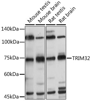 TRIM32 Rabbit pAb