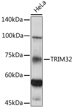 TRIM32 Rabbit pAb