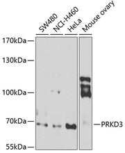PRKD3 Rabbit pAb