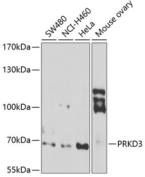 PRKD3 Rabbit pAb
