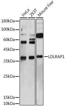 LDLRAP1 Rabbit pAb