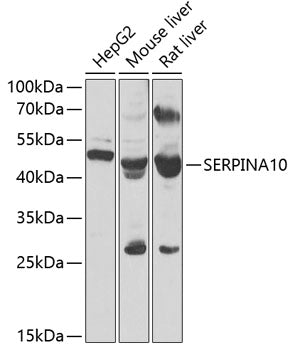 SERPINA10 Rabbit pAb