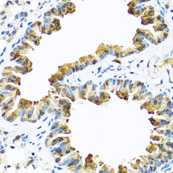 SERPINA10 Rabbit pAb