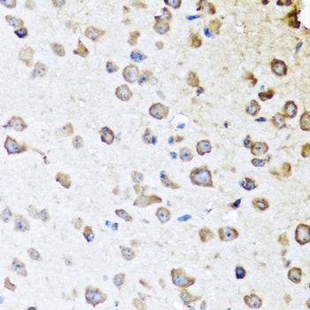 SERPINA10 Rabbit pAb
