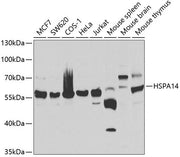 HSPA14 Rabbit pAb